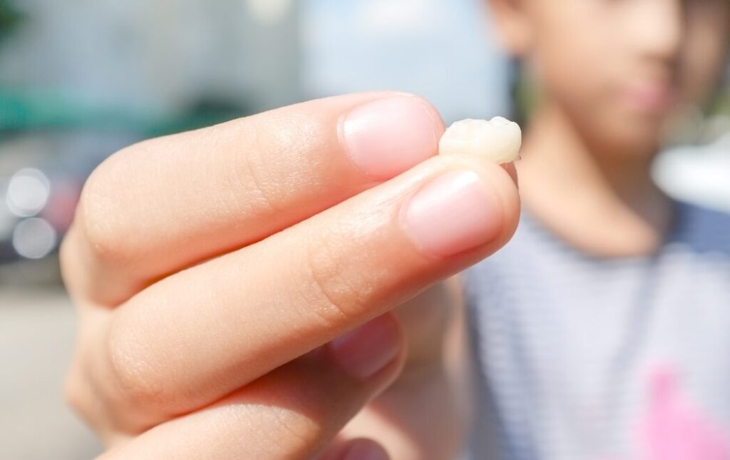 子どもが乳歯を見せている